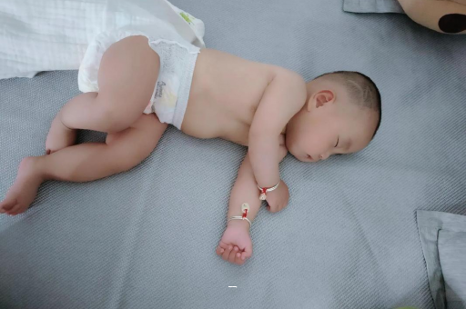 桐乡宝宝脸上有白色斑块